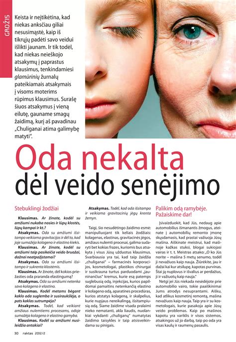 Statistika apie avarijas dėl vairo gedimų