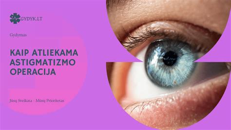 Schema, kaip atliekama kataraktos operacija