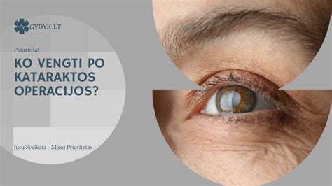 Ilustracija, rodanti, ko vengti po kataraktos operacijos