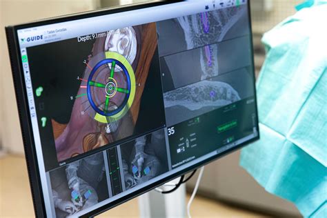 4MATIC sistemos veikimas