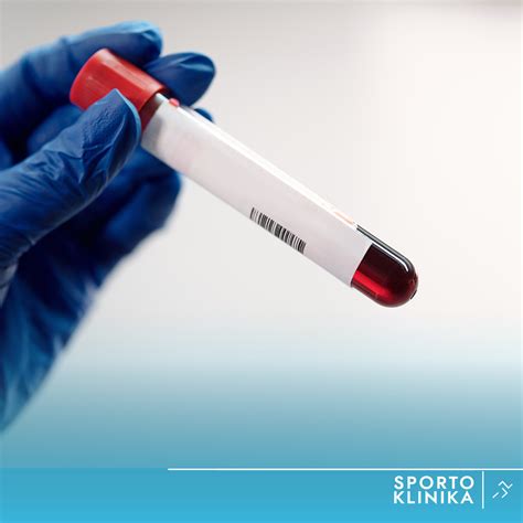 Žmogaus kraujo mėginio tyrimas