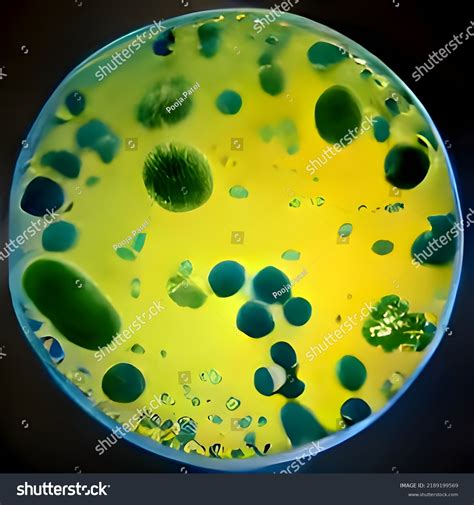 Stabligės bakterija mikroskopu