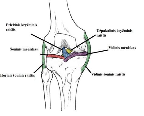 Kelio sąnario protezo schema
