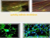 Įtampos stabilizatoriaus vidinė struktūra