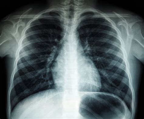 Medicininiai tyrimai: rentgeno nuotrauka