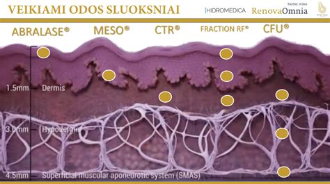 Elektroporacijos procedūros schema
