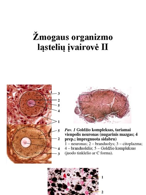 Žmogaus seksualumo įvairovė