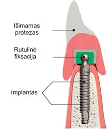 Schematinis pusašio su granatomis vaizdas
