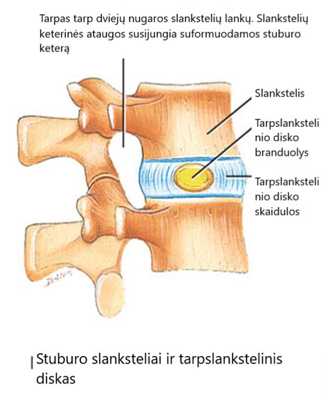 Tarpslankstelinio disko sandara