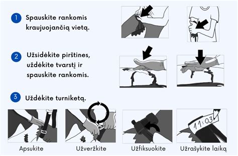 Schematinis turniketo naudojimas