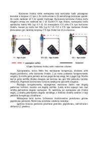 Infografika: Dažniausi variklio kompresijos problemų simptomai