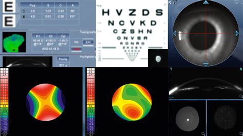 akių patikrinimas vairuotojams