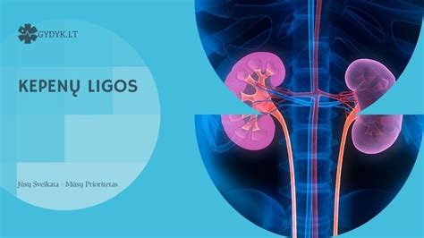 Simuliuojamos ligos ir jų pasekmės
