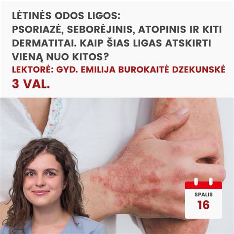 Infografika: Kaip atskirti faktą nuo nuomonės ir kokios pasekmės už melagingos informacijos skelbimą