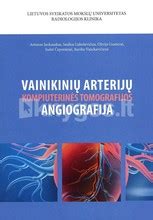 Schematinis vainikinių arterijų vaizdas
