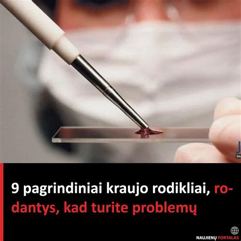 Simboliai rodantys vairo problemų