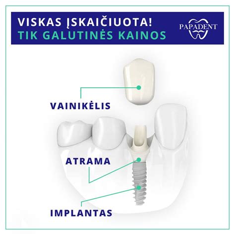 Cirkonio oksido vainikėlio uždėjimas