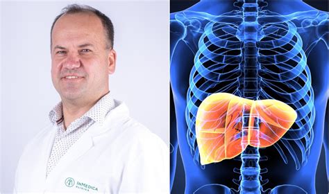 Simptomai sugedusiam išmetimo kolektoriui