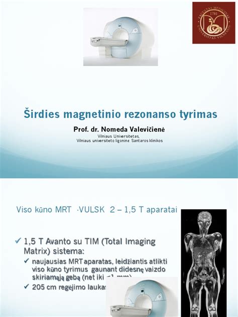 Širdies MRT vaizdas