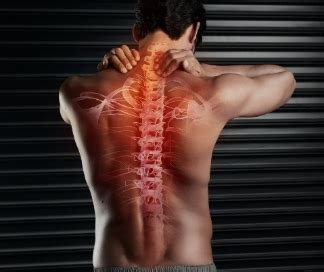 Skeletas su pažymėta stuburo trauma